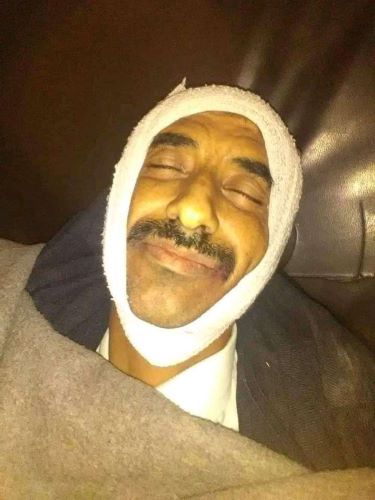 ملسحون يغتالون قائد الحزام الأمني في قعطبة بمحافظة الضالع