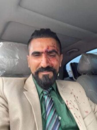 محامي "عبدالله الأغبري"  يتعرض لاعتداء أثناء خروجه من المحكمة بصنعاء