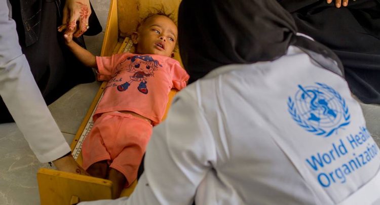 الصحة العالمية : أنشأنا 30 مركزا جديداً للتغذية العلاجية في اليمن 