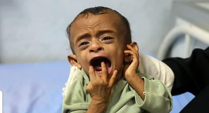 منظمة دولية : مقتل أكثر من 2300 طفل في اليمن خلال ثلاث سنوات