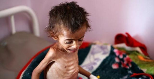 yemen-famine